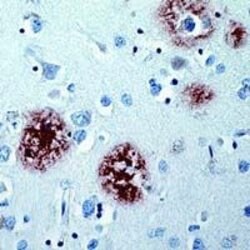 beta Amyloid Rabbit anti-Human, Polyclonal, Invitrogen 1 mL; Unconjugated:Antibodies,