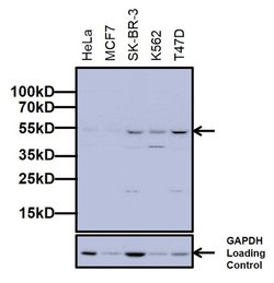 Invitrogen beta Arrestin 1 Monoclonal Antibody (4E11B1) 100 &mu;g; Unconjugated:Antibodies,