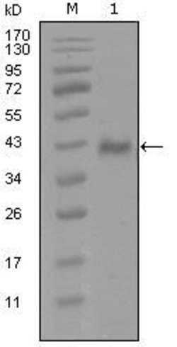 Invitrogen Androgen Receptor Monoclonal Antibody (1A9D12) 100 &mu;L; Unconjugated:Antibodies,