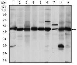 Invitrogen ASS1 Monoclonal Antibody (2B10) 100 &mu;g; Unconjugated:Antibodies,