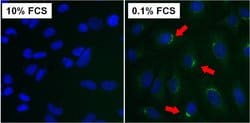 Invitrogen ATG9A Monoclonal Antibody (14F2 8B1) 100 &mu;g; Unconjugated:Antibodies,