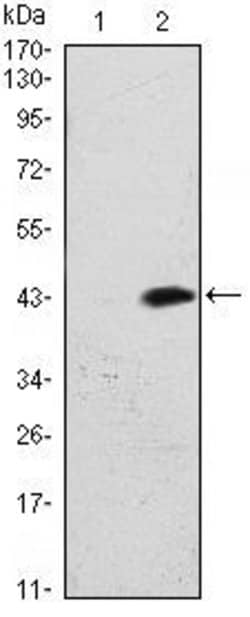 Invitrogen ATM Monoclonal Antibody (5C5) 100 &mu;L | Buy Online | Invitrogen&trade; | Fisher Scientific