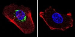 Invitrogen ATP Synthase beta Monoclonal Antibody (4.3E8.D10) 100 &mu;g;