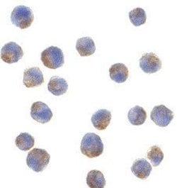 Invitrogen Adiponectin Polyclonal Antibody 100 &mu;g; Unconjugated:Antibodies,