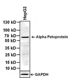 Invitrogen AFP Monoclonal Antibody (P5B8) 100 &mu;g; Unconjugated:Antibodies,