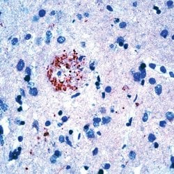 Invitrogen Amyloid Precursor Protein Polyclonal Antibody 1 mL; Unconjugated:Antibodies,