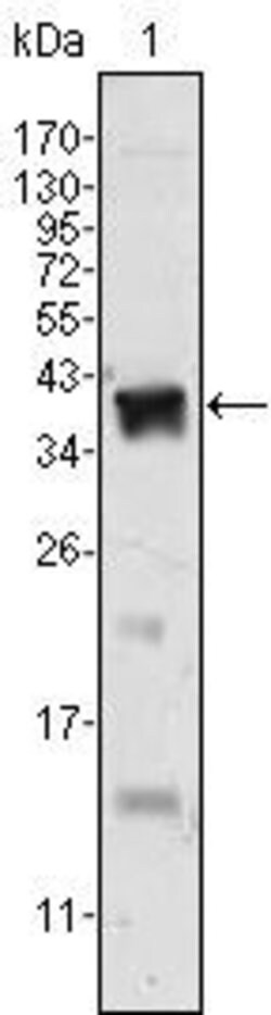 Invitrogen Androgen Receptor Monoclonal Antibody (2H8) 100 &mu;L | Buy Online | Invitrogen&trade; | Fisher Scientific