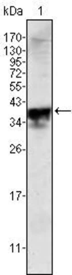 Invitrogen Androgen Receptor Monoclonal Antibody (2H8) 100 &mu;L | Buy Online | Invitrogen&trade; | Fisher Scientific