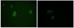 Invitrogen Apolipoprotein M Monoclonal Antibody (10C3G5) 100 &mu;g; Unconjugated:Antibodies,