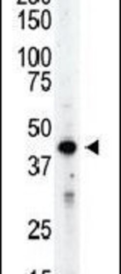 Aurora B Rabbit anti-Human, Mouse, Polyclonal, Invitrogen 400 &mu;L; Unconjugated:Antibodies,