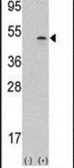Aurora B Rabbit anti-Human, Mouse, Polyclonal, Invitrogen 400 &mu;L; Unconjugated:Antibodies,
