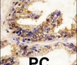 B-Raf Polyclonal Antibody, Invitrogen 400 &mu;L; Unconjugated:Antibodies,