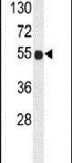 B3GNT6 Rabbit anti-Human, Mouse, Polyclonal, Invitrogen 400 &mu;L; Unconjugated:Antibodies,
