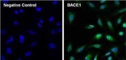 Invitrogen BACE1 Monoclonal Antibody (3C1C3) 100 &mu;g; Unconjugated:Antibodies,