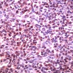 BCL6 Rabbit anti-Human, Polyclonal, Invitrogen 500 μL; Unconjugated:Antibodies,