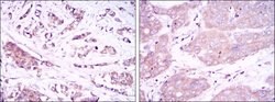 Invitrogen Beclin 1 Monoclonal Antibody (2A4) 100 &mu;L; Unconjugated:Antibodies,