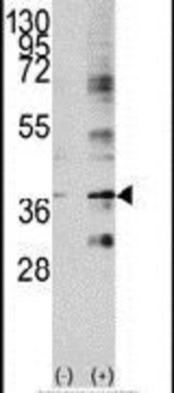 Livin Rabbit anti-Human, Polyclonal, Invitrogen 400 &mu;L; Unconjugated:Antibodies,