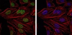 Invitrogen BMI-1 Monoclonal Antibody (3E3) 100 &mu;L; Unconjugated:Antibodies,