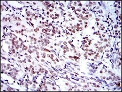 Invitrogen BMI-1 Monoclonal Antibody (3E3) 100 &mu;L; Unconjugated:Antibodies,