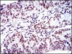 Invitrogen BMI-1 Monoclonal Antibody (3E3) 100 &mu;L; Unconjugated:Antibodies,