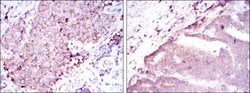 Invitrogen BMPR2 Monoclonal Antibody (1F12) 100 &mu;L; Unconjugated:Antibodies,