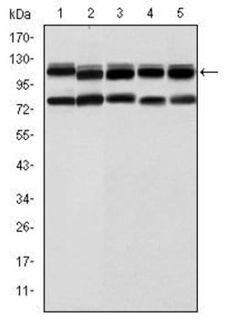 Invitrogen BMPR2 Monoclonal Antibody (1F12) 100 &mu;L; Unconjugated:Antibodies,