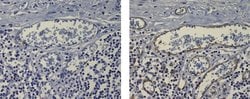 Invitrogen CD31 (PECAM-1) Monoclonal Antibody (Gi18), eBioscience 100 &mu;g;