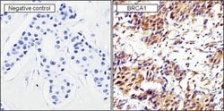 Invitrogen BRCA1 Monoclonal Antibody (MS110) 100 &mu;g; Unconjugated:Antibodies,