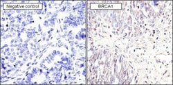 Invitrogen BRCA1 Monoclonal Antibody (MS110) 100 &mu;g; Unconjugated:Antibodies,
