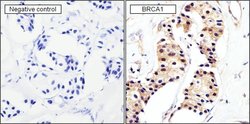 Invitrogen BRCA1 Monoclonal Antibody (MS13) 100 &mu;g; Unconjugated:Antibodies,