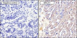 Invitrogen BRCA1 Monoclonal Antibody (MS13) 100 &mu;g; Unconjugated:Antibodies,