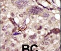 Btk Rabbit anti-Human, Polyclonal, Invitrogen 400 &mu;L; Unconjugated:Antibodies,