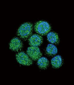 Btk Rabbit anti-Human, Polyclonal, Invitrogen 400 &mu;L; Unconjugated:Antibodies,