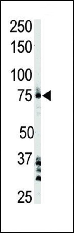 Btk Rabbit anti-Human, Polyclonal, Invitrogen 400 &mu;L; Unconjugated:Antibodies,