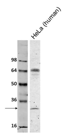 Invitrogen Bcl-2 Monoclonal Antibody (Bcl-2-100) 100 &mu;g; Unconjugated:Antibodies,