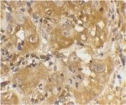 Invitrogen Bim Polyclonal Antibody 100 &mu;g; Unconjugated:Antibodies,