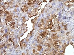 Invitrogen Blood Group B Antigen Monoclonal Antibody (HEB-29) 1 mL; Unconjugated:Antibodies,