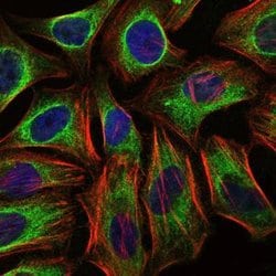 Invitrogen c-Cbl Monoclonal Antibody (3B12) 100 &mu;L; Unconjugated:Antibodies,