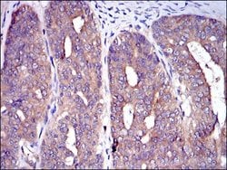 Invitrogen c-Cbl Monoclonal Antibody (3B12) 100 &mu;L; Unconjugated:Antibodies,
