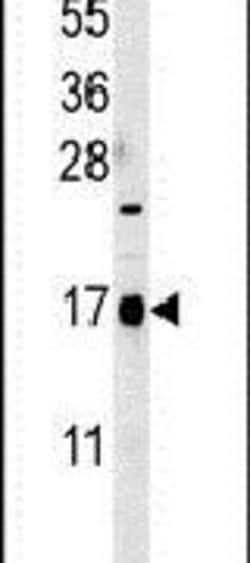 CA095 Rabbit anti-Human, Mouse, Polyclonal, Invitrogen 400 &mu;L; Unconjugated:Antibodies,