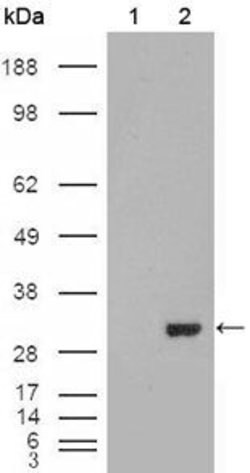 Invitrogen Carbonic Anhydrase I Monoclonal Antibody (9D6D7) 100 &mu;L;
