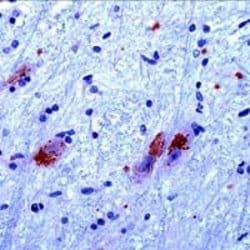 CaMKIV Rabbit anti-Human, Rat, Polyclonal, Invitrogen 1 mL; Unconjugated:Antibodies,