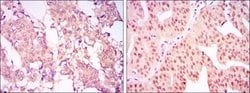 Invitrogen PRMT4 Monoclonal Antibody (3H2) 100 &mu;L; Unconjugated:Antibodies,