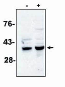 Invitrogen Caspase 7 Monoclonal Antibody (MCH3-5) 100 &mu;g; Unconjugated:Antibodies,