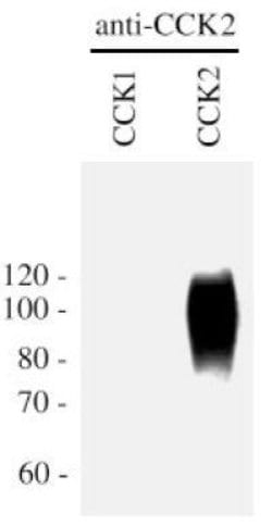Invitrogen CCKBR Polyclonal Antibody 100 &mu;L; Unconjugated:Antibodies,