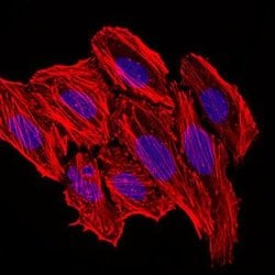 Invitrogen MCP-1 Monoclonal Antibody (2D8) 100 &mu;g; Unconjugated:Antibodies,