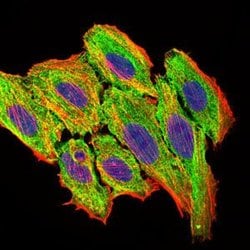 Invitrogen MCP-1 Monoclonal Antibody (2D8) 100 &mu;g; Unconjugated:Antibodies,