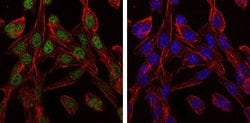 Invitrogen TCP-1 beta Monoclonal Antibody (5B5C4) 100 &mu;L; Unconjugated:Antibodies,