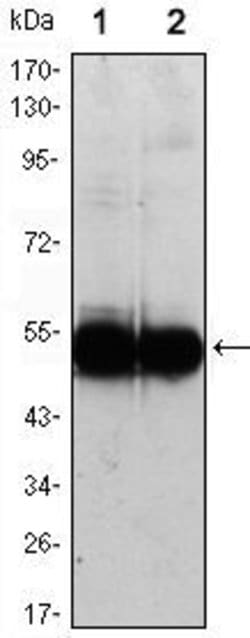 Invitrogen VCAM-1 Monoclonal Antibody (6G9) 100 &mu;L; Unconjugated:Antibodies,