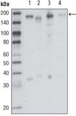 Invitrogen RON Monoclonal Antibody (1B5A9) 100 &mu;L; Unconjugated:Antibodies,